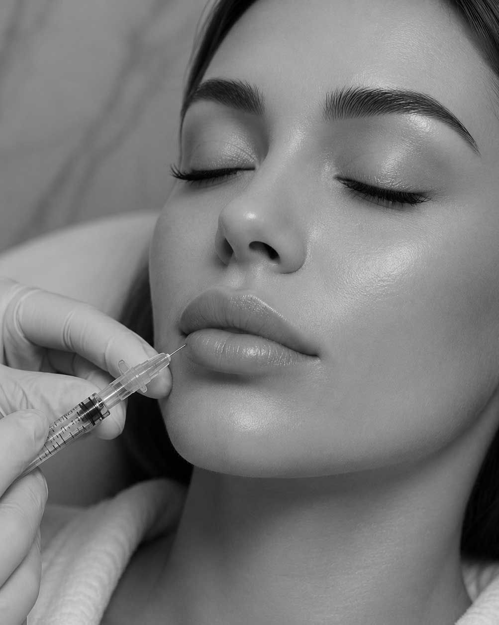 Lip filler Beverly Hills